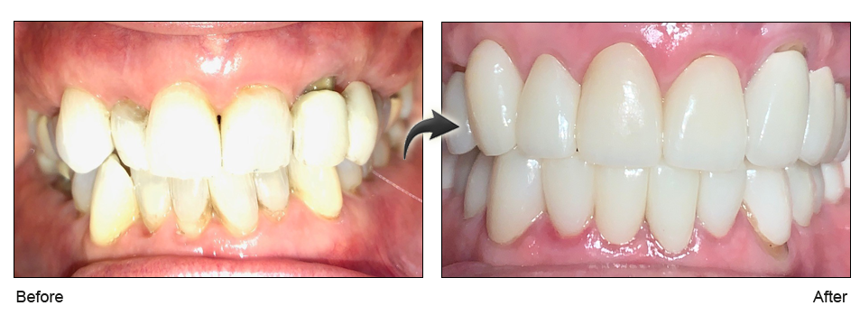 gum treatment San Jose